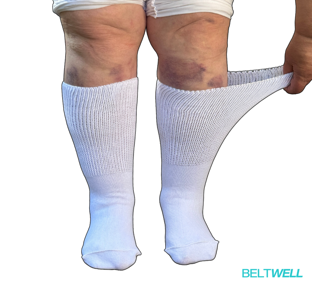 Beltwell® - The Oversized Circulation Socks For Swollen Legs & Feet (2 pairs)