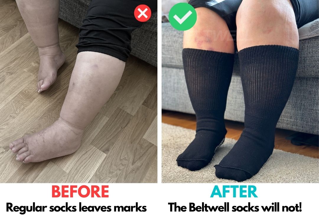 20 Pack - Oversized Circulation Socks